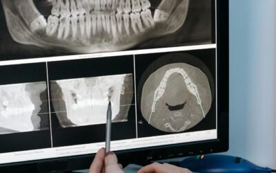 Benefits and Safety of Dental Radiographs